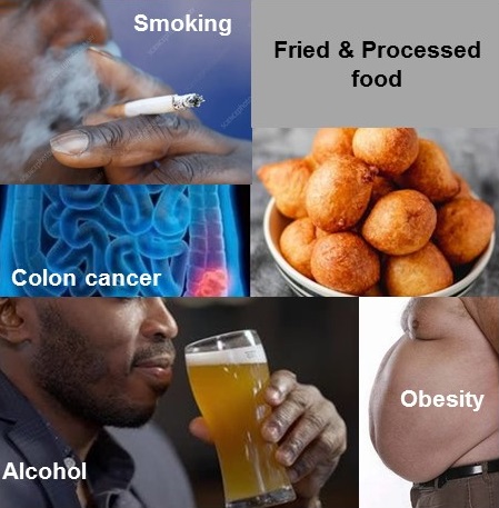 Some unhealthy lifestyles contribute to colon cancer 